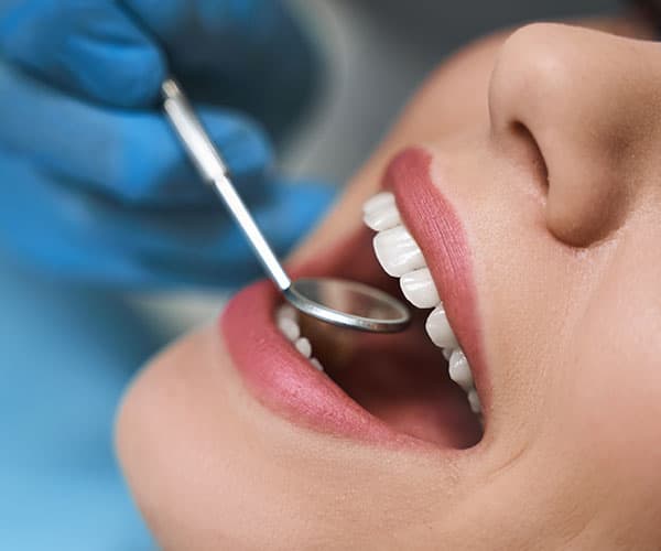 carillas-dentales-san-fernando-revisando-dientes