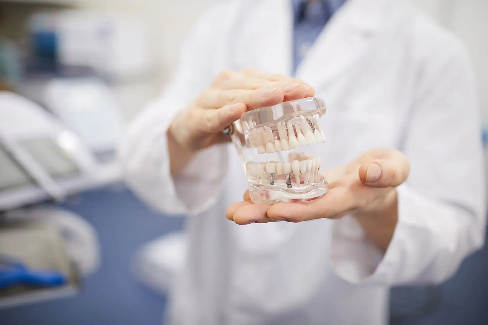 implantes-dentales-jerez-cabecera