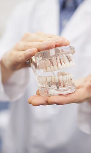 tratamiento-de-atm-jerez-de-la-frontera-dientes-cristal