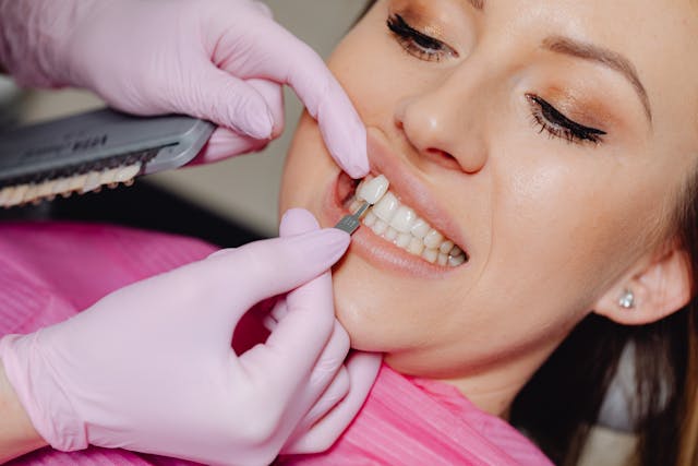 edad para ponerse las carillas dentales