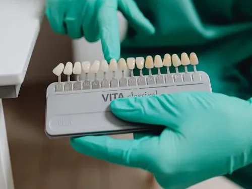 Cuanto duran las carillas de porcelana